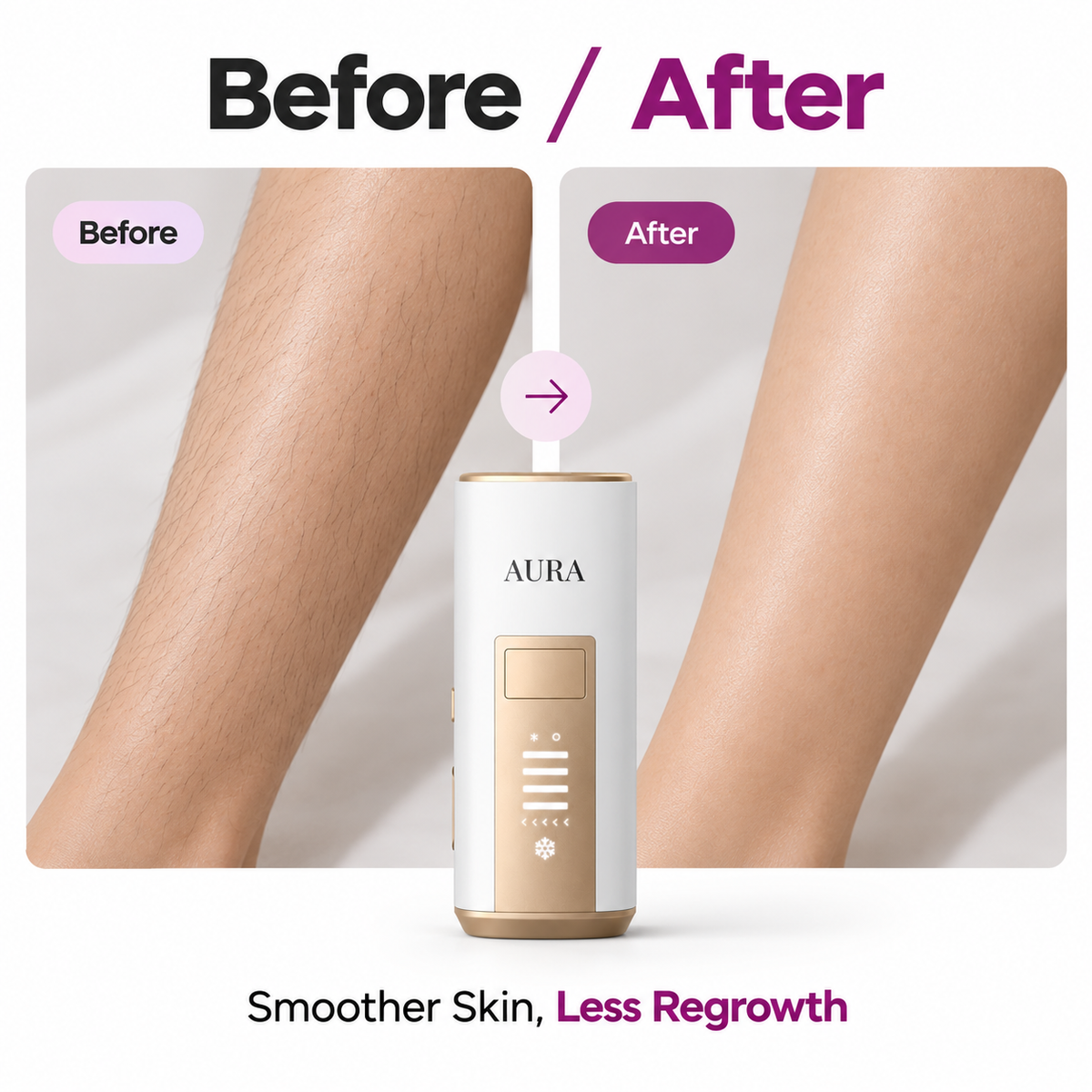 IPL Hair Removal Set